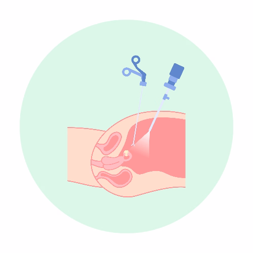 Laparoscopic Surgeon